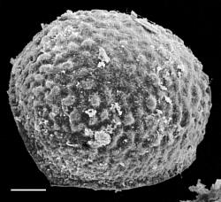 Isoetes kirkii. SEM distal view of macrospore showing tubercled surface. From photos by D.M. Britton attached to WELT P005837/A. Scale bar = 100 μm.
 Image: J.C. Stahl © Te Papa CC BY-NC 3.0 NZ